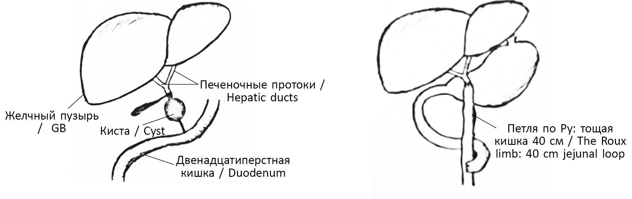 Ахоличный стул у детей